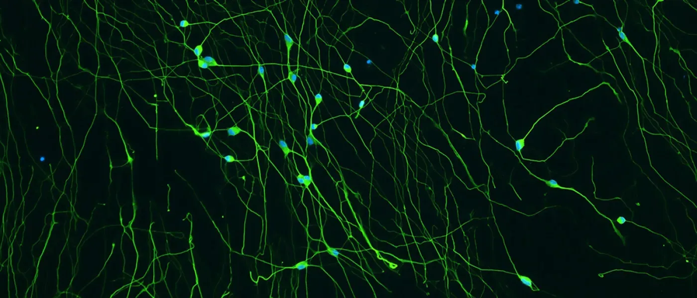 A network of long cells under a microscope